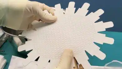 Une matrice dermique pour prothèses mammaires en peau de cochon.